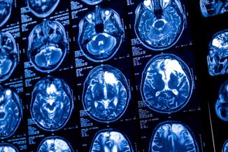 AI: An unknown risk for life insurers
